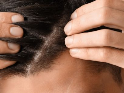 223.-como-fortalecer-pelo