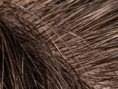 9.-cual-es-la-composicion-del-pelo