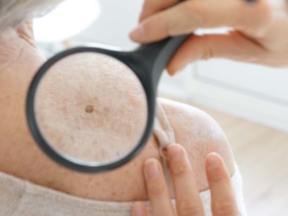 68.-tratamiento-despigmentante-protege-tu-piel-frente-a-las-manchas