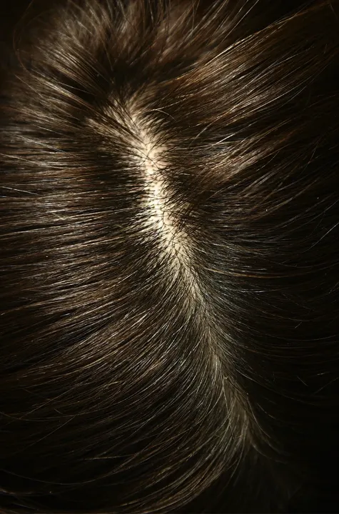 2.Iraltone_TRIPLE IMAGE_Cabello_713x1080