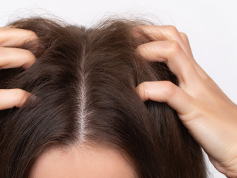 Beneficios_pelo graso _400x300_344x258_3