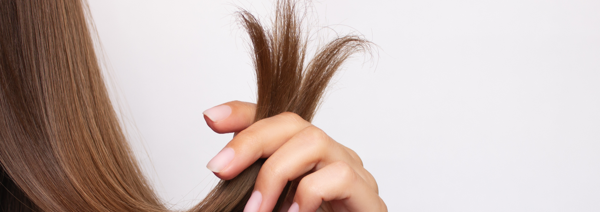 BANNER IMG_1929x680_Alopecia4