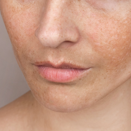 IMG+TEXT_432x432-MANCHASjpg