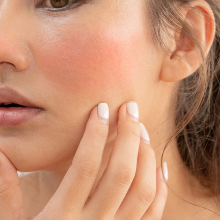 IMG+TEXT_432x432-ENROJECIDA