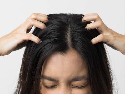 Beneficios_Caspa_400 × 300_malestar